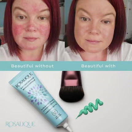 Rosalique 3 in 1 Anti-Redness Miracle Formula