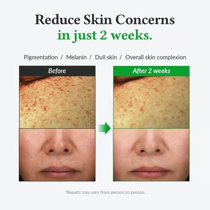 Dr. Althea Gentle Vitamin C Serum for Skin Tone and Pigmentation
